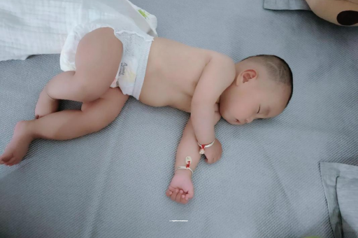 云南宝宝头上长痱子